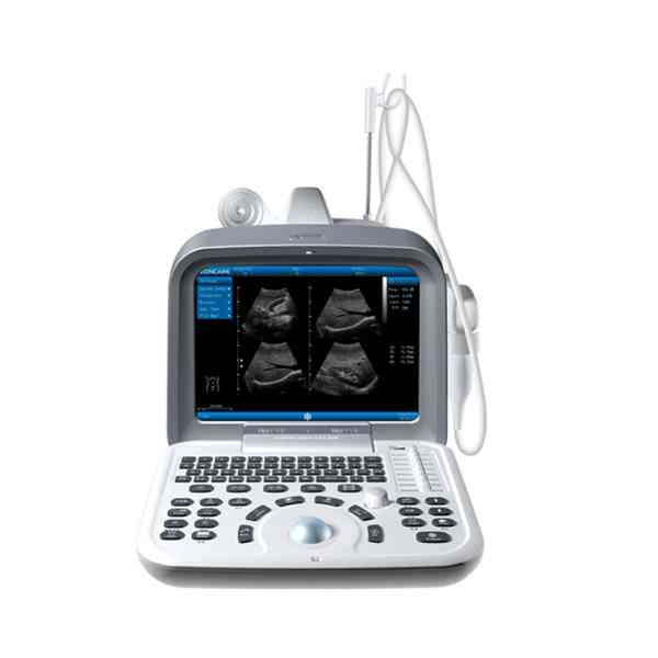 Ultrasound System