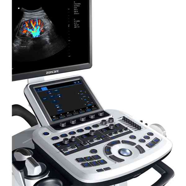 Doppler Ultrasound System