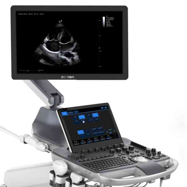 Ultrasound System
