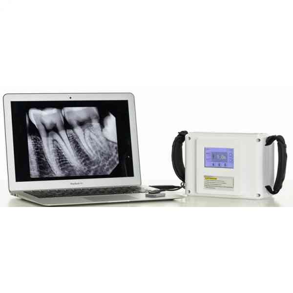 Portable Handheld Dental X-ray Camera - Image 2