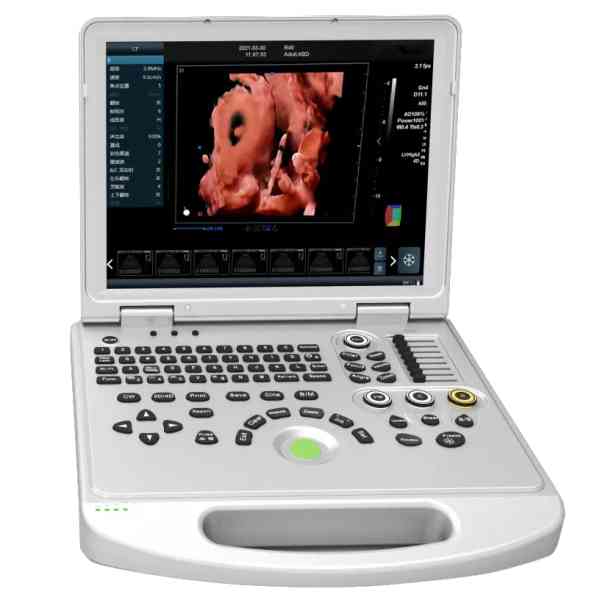Doppler ultrasound machine - Image 2