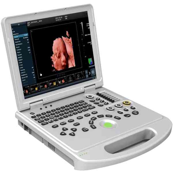 Doppler ultrasound machine - Image 3