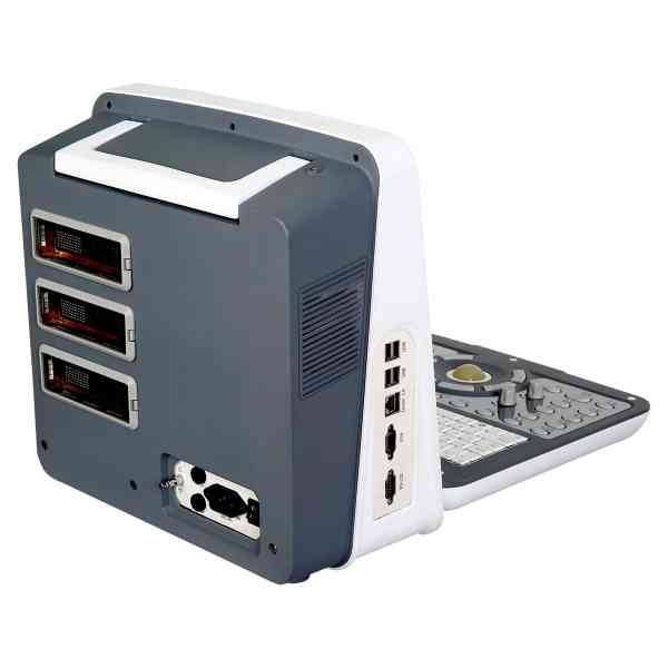 Full Digital Color Doppler Diagnostic System - Image 4