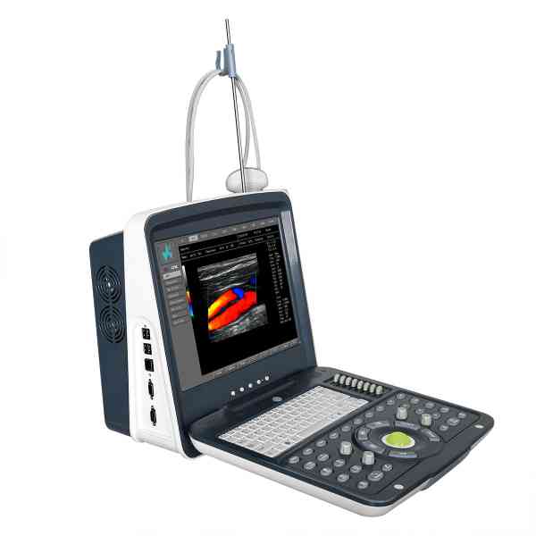 Full Digital Color Doppler Diagnostic System - Image 2
