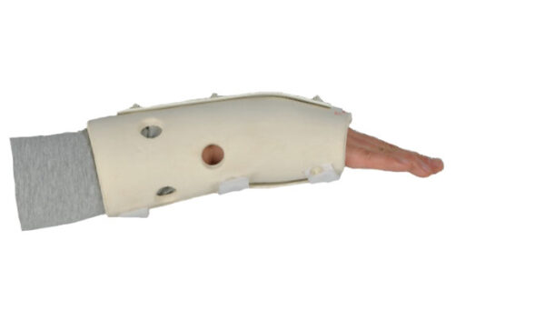External Fixation Brace - Image 3