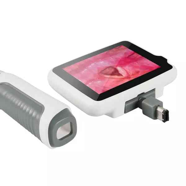 Video Laryngoscope - Image 2