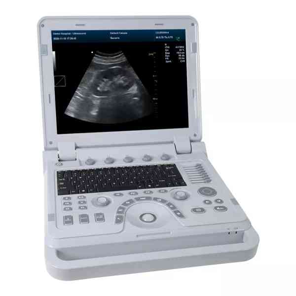 Color Doppler Ultrasonic Diagnostic System - Image 2